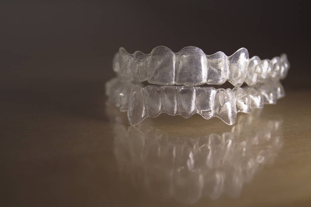 Alinhadores Invisíveis Itabaiana