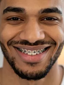 Saiba tudo sobre ClearCorrect