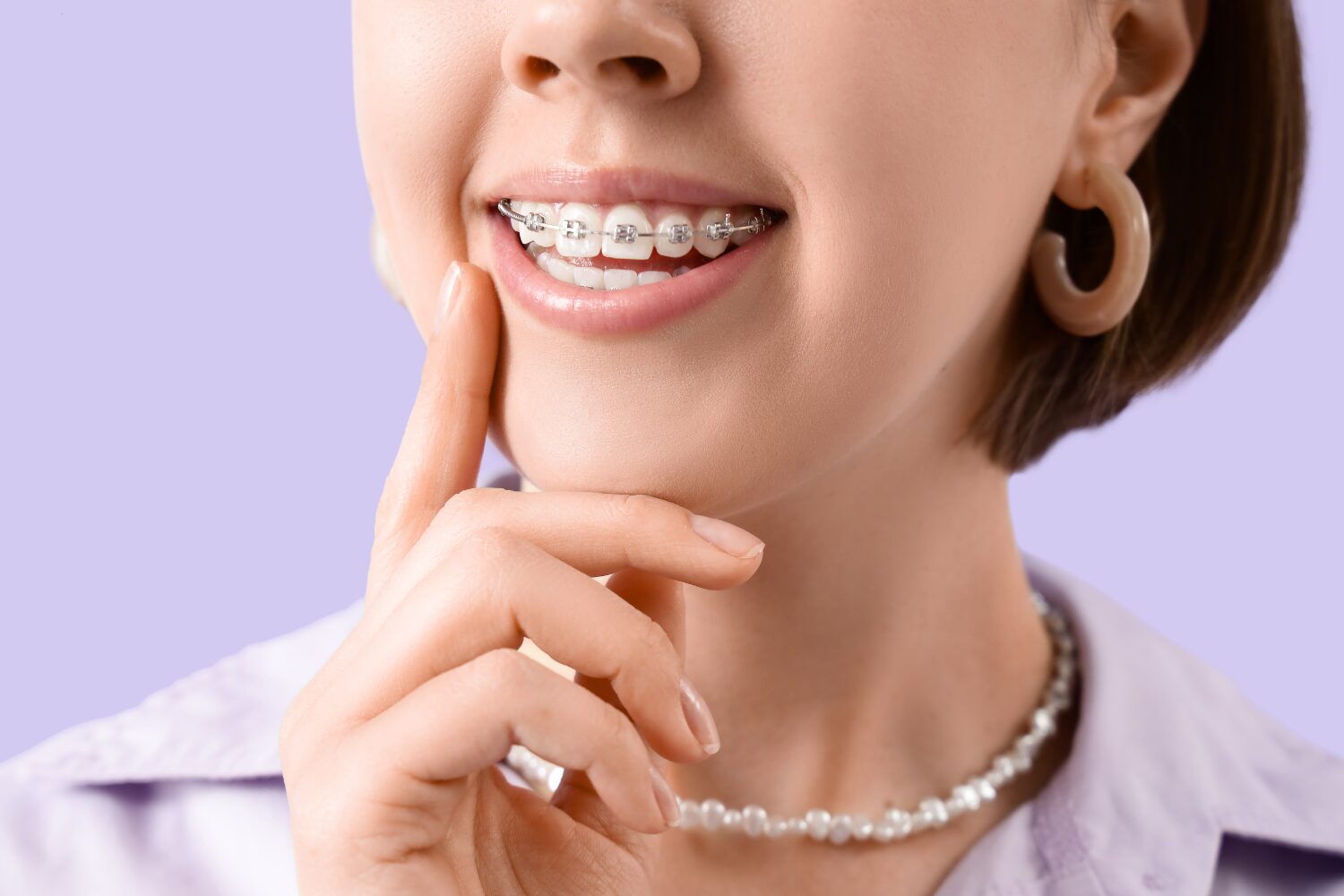 Aparelho Ortodôntico Fixo de Metal Como Funciona e Quando É Indicado