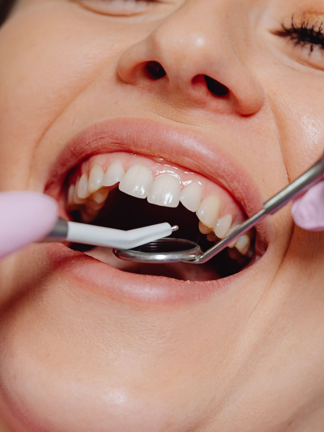 O Invisalign revolucionou a forma como as pessoas corrigem os dentes, oferecendo uma alternativa moderna, confortável e praticamente invisível ao aparelho fixo.